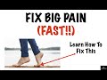 FIX BIG TOE PAIN (FAST!!!)