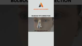 Bulbous Tip Correction | Answer Plastic Surgery #shorts #bulboustipcorrection screenshot 4