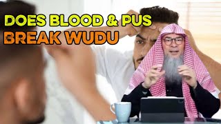 Does Blood & Pus Break Wudu? – Clear Islamic Ruling by Assim Al Hakeem