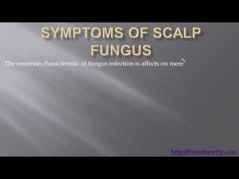 fungus-of-the-scalp's-symptoms,-preventing-and-treatment