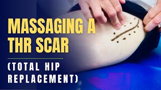 Massage Over Total Hip Replacement THR Scar