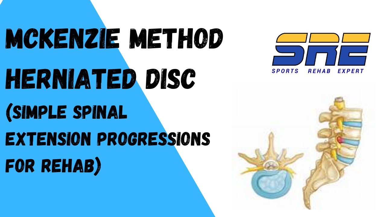 McKenzie Method and Herniated Discs Spinal Extension Progressions