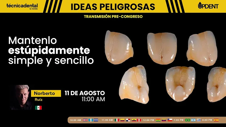 Mantenlo estpidamente simple y sencillo con el TPD...