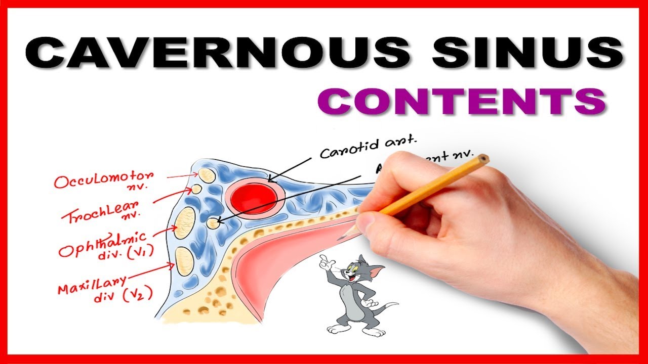 Cavernous Sinus Contents Mnemonic / Mnemonic series #19 - YouTube