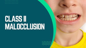 Class II Malocclusion: Invisalign vs. Braces - Which Is Better?