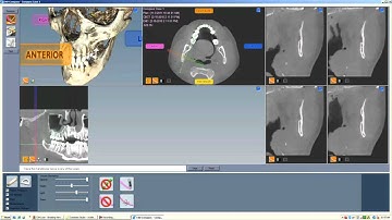 Compass: Nerve Mapping