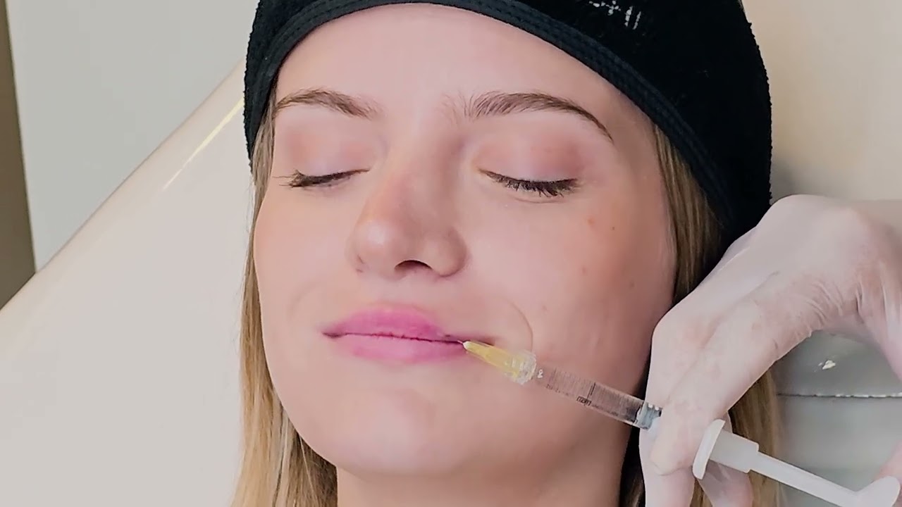 Tutorial: Cómo Rellenar Labios Vírgenes de Forma SEGURA y DELICADA
