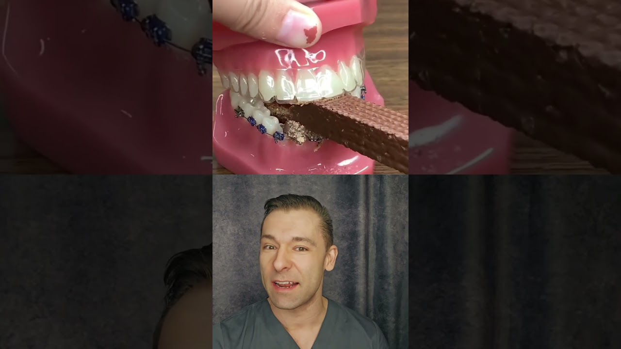 Waffel essen mit Zahnspange 