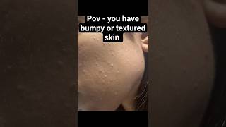 Famous How to get rid of textured or bumpy skin #skincare #shorts Net Worth
