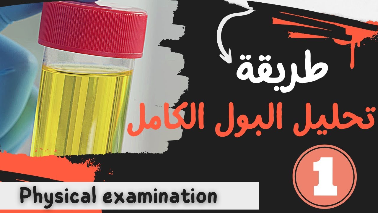 9_طريقة عمل تحليل البول الكامل بكل سهوله (الفحص الفيزيائي الجزء الاول)