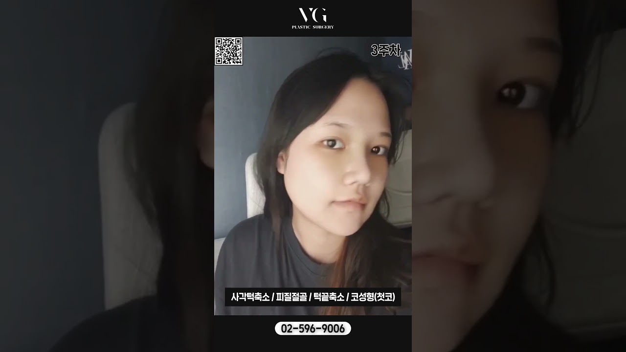 [Бэрри Гүүд гоо сайхны мэс заслын эмнэлэг] #НүүрнийХэлбэрЗасах сайн эмнэлэг Ганнам станцад байдаг гэж үү?? Алдартангууд ч хийлгэдэг Бэрри Гүүдийн нүүрний хэлбэр засах мэс заслаар илүү үзэсгэлэнтэй, илүү гоёмсог болцгооё 👀