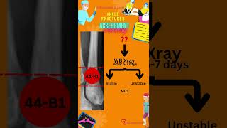 ANKLE FRACTURES STABILITY ASSESSMENT PART II