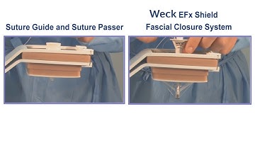 Weck™ EFx Shield™- Fascial Closure System vs Suture Guide