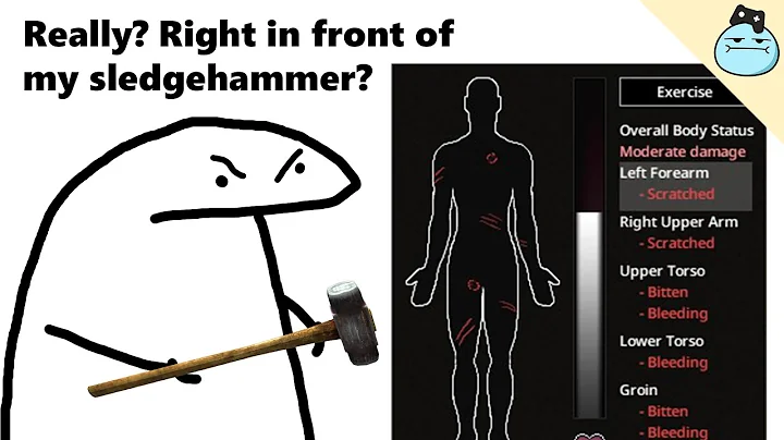 Types Of Players When They Get Bitten 2 - Project Zomboid