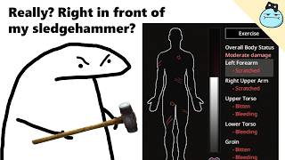 Types Of Players When They Get Bitten 2 - Project Zomboid