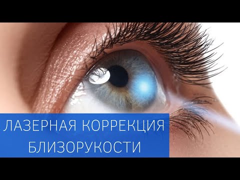 Лазерная коррекция близорукости (операция Lasik)