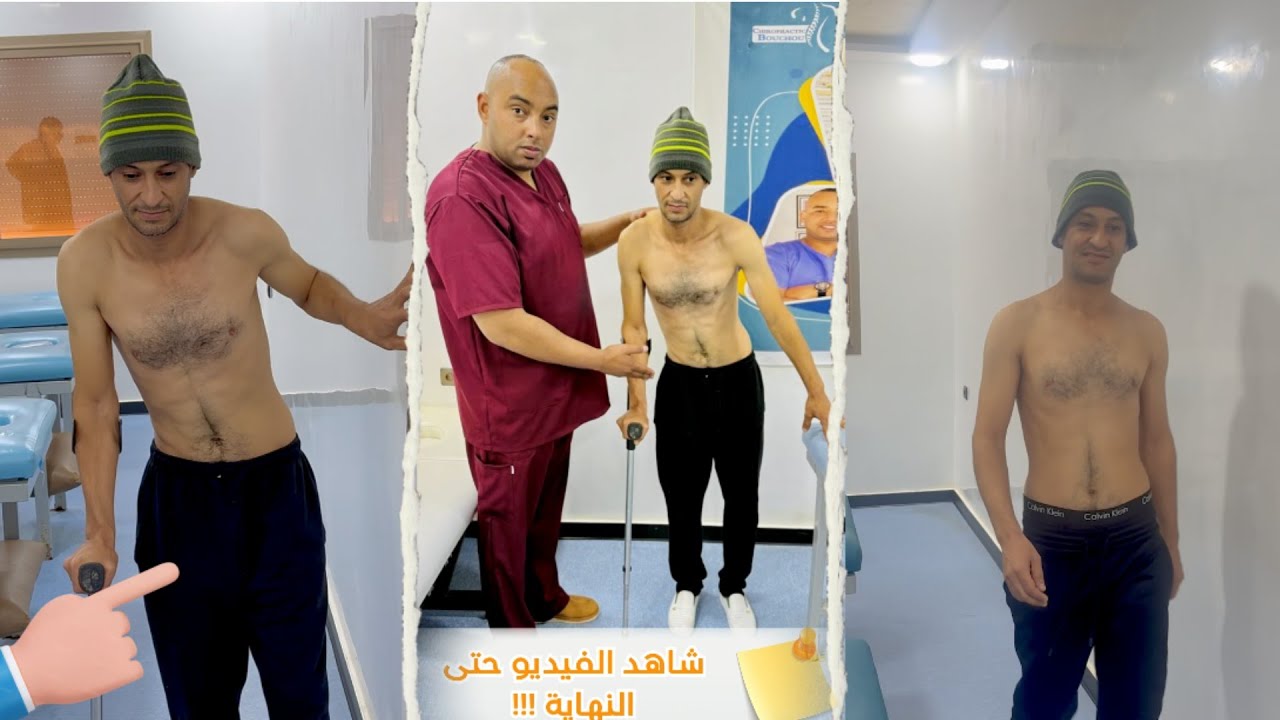 شفاء هذا المريض😢 من اعوجاج العمود الفقري 😃(scoliose)