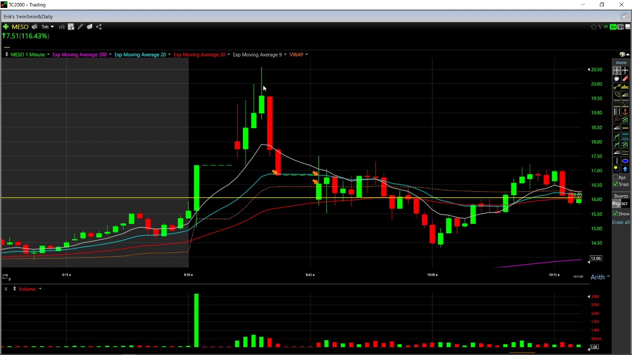 Day trading MDGS, MESO and HOTH!