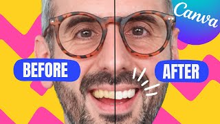 How to Make your Teeth look Whiter in Canva😀🌟 | Shorts screenshot 1