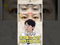 쌍꺼풀 수술 `만` 하면 안되는 유형이 있다고...?
