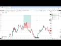 Biggest Trading Mistake of 2026 | Took Silver Instead of Gold (Cost Me 100 Pips)