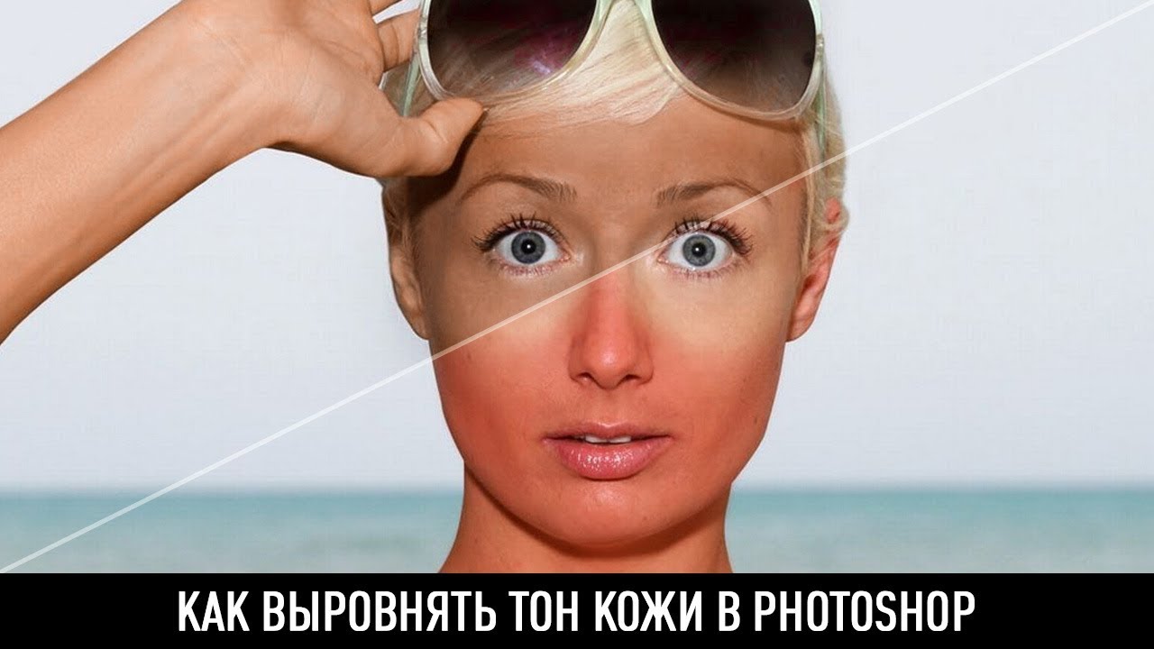 Как выровнять капот