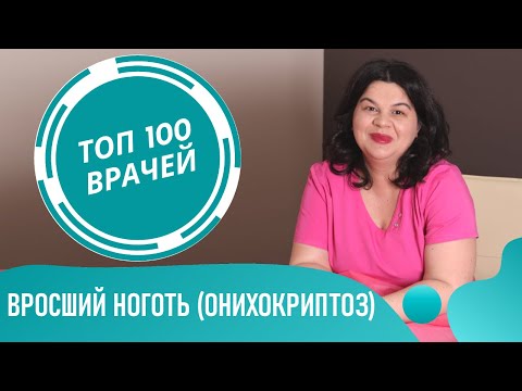 Вросший ноготь (онихокриптоз). Причины и лечение вросшего ногтя. Как лечить вросший ноготь