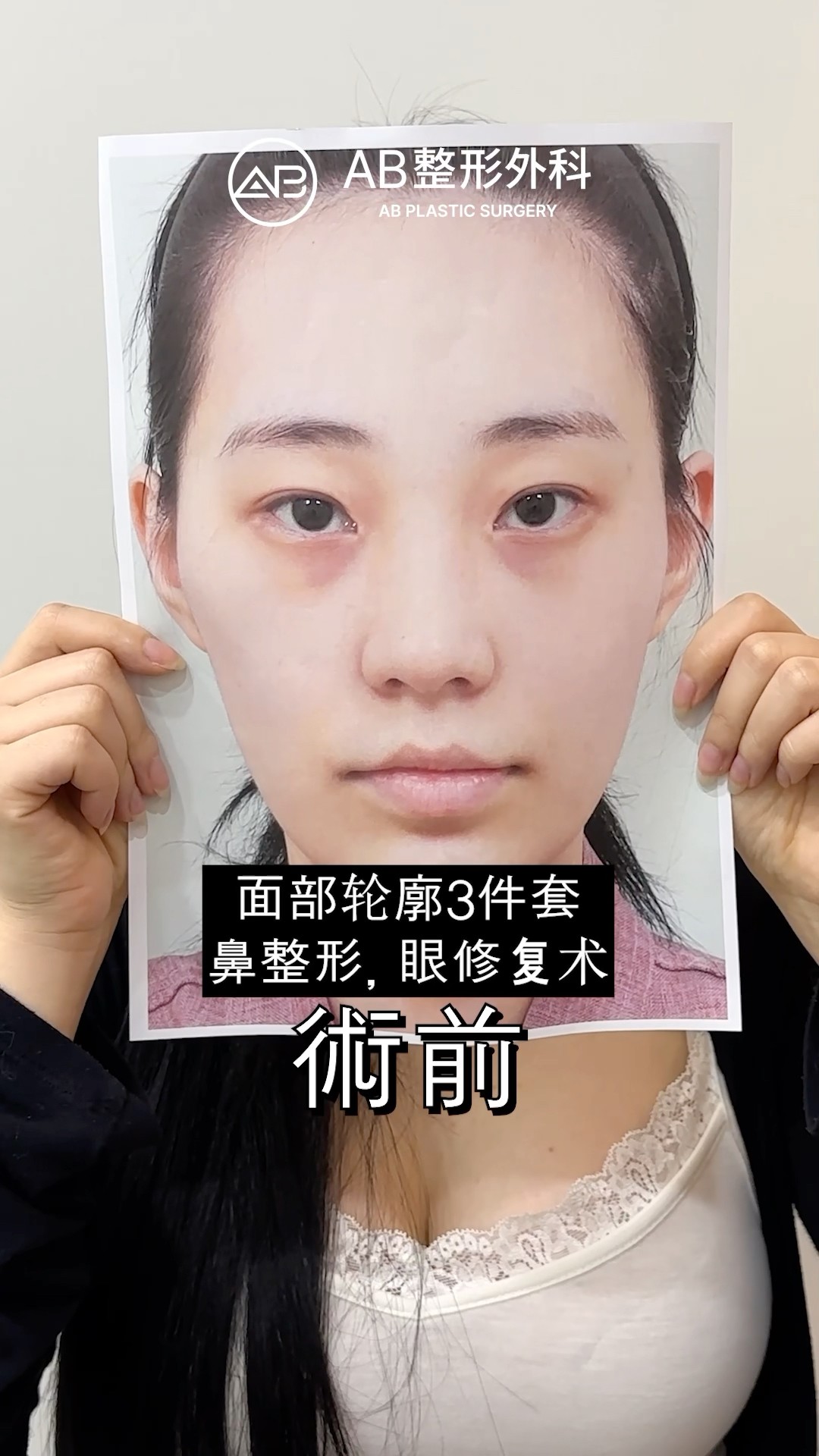 你覺得變漂亮了嗎？#shorts