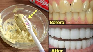 how to make white teeth | teeth whitening at home remedies  Alihuma life  video