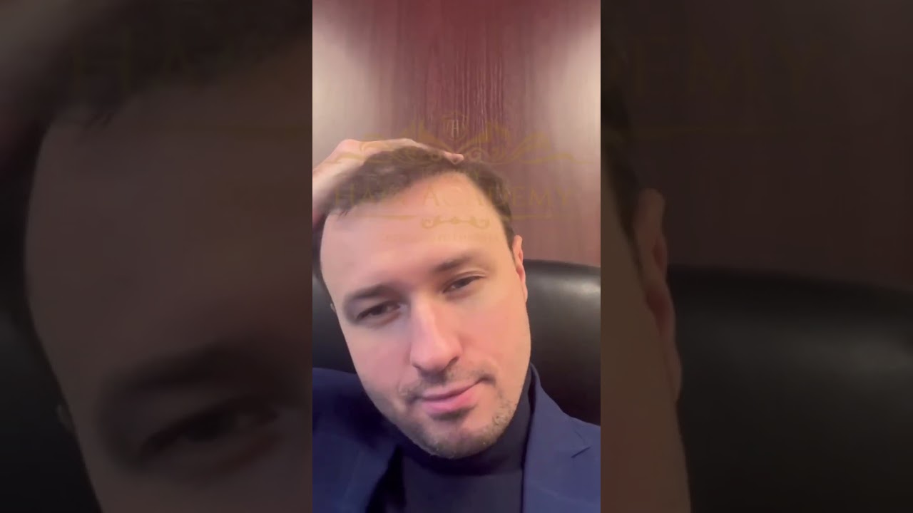 TURKISH HAIR ACADEMY| Hair Transplant Clinic