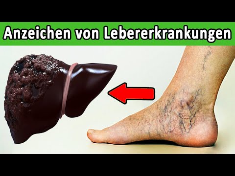 Video: Triampur - Gebrauchsanweisung, Indikationen, Analoga, Testberichte