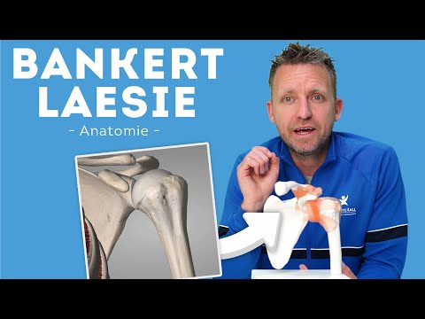 Bankart Laesie - Herstel & Revalidatie