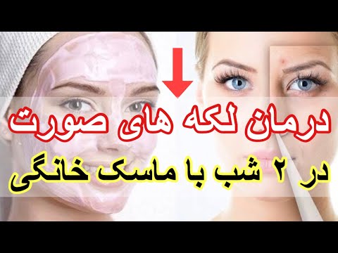 تصویری: نحوه ترجمه به قهوه ای