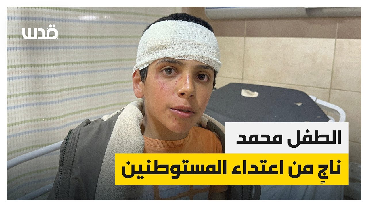 الطفل محمد سامي عودة غزال دهسه مستوطن ولاحقه في قرية كيسان - بيت لحم