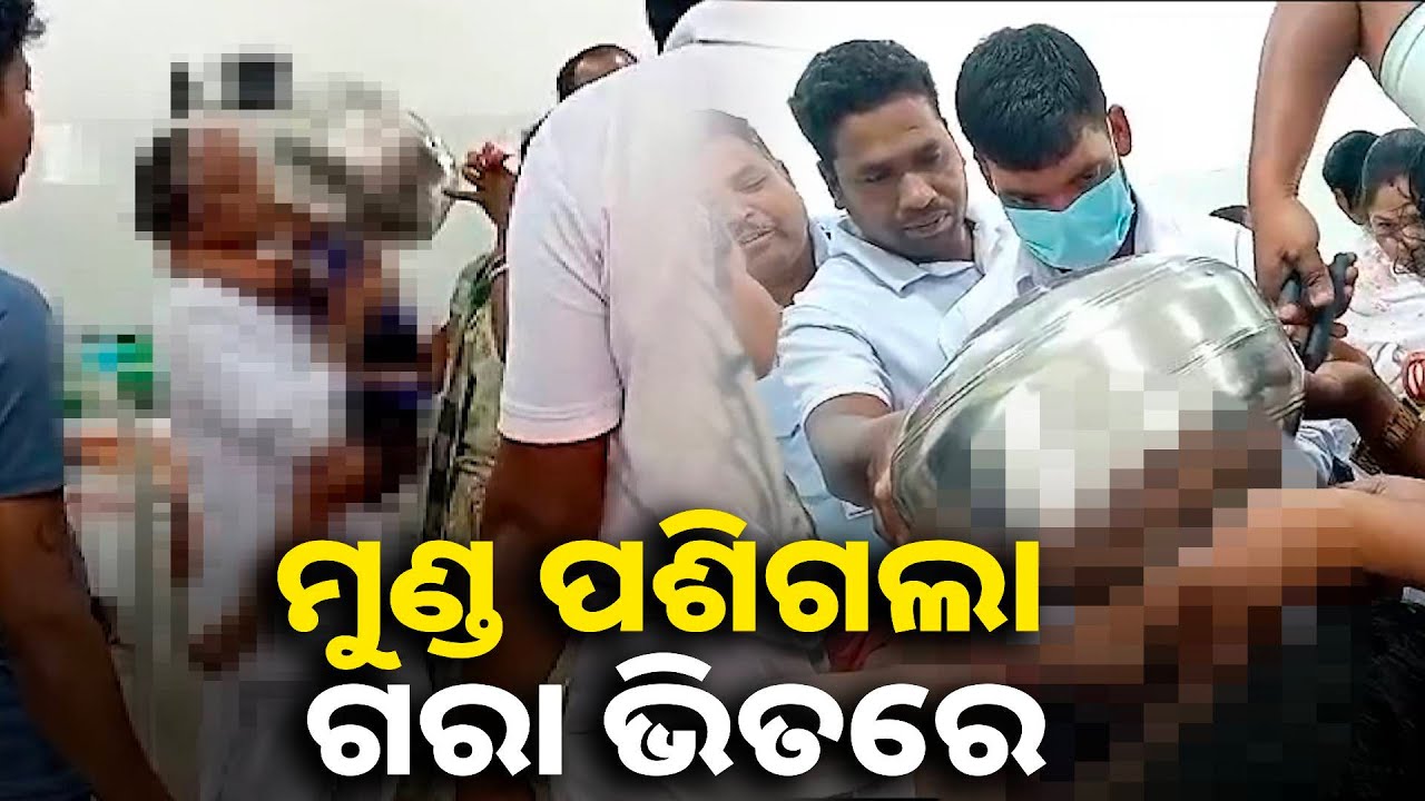 ଚାରି ବର୍ଷ ପିଲାଟିର ମୁଣ୍ଡ ଗରା ଭିତରେ ପଶିଗଲା, କାଢ଼ିବାକୁ ନାକେଦମ୍ ହୋଇଗଲେ ଡାକ୍ତର || Knews odisha