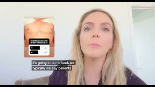 Nipple sensation in free nipple grafts