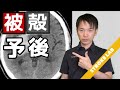 【被殻出血の症状と予後予測】 リハビリテーション・看護/ひかく出血
