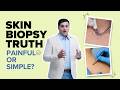 Skin Biopsy Truth: Painful or Simple? Doctor Explains