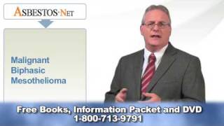 Malignant Biphasic Mesothelioma Asbestos