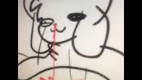 how do i delet smule song