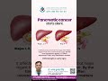 Pancreatic Cancer Warning Signs | Early Symptoms You Should NEVER Ignore | Cancer Awareness