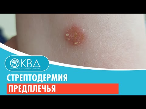 Видео: Комплект 