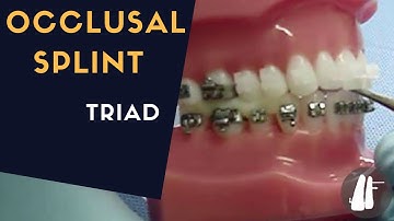 OCCLUSAL SPLINT