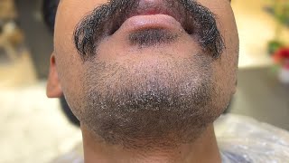 Beardruff ASMR: Easy how-to to remove beard dandruff fast