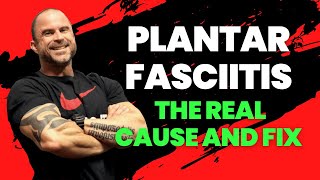Plantar Fasciitis and The Real Cause and Fix | Trevor Bachmeyer | SmashweRx