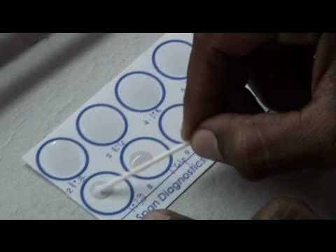 Rpr микробиология. Rpr, рмп. Антиген кардиолипиновый для рмп 2мл №10. Сифилис rpr (rapid plasma reagin – антикардиолипиновый тест). Сифилис rpr (rapid plasma reagin – антикардиолипиновый тест).