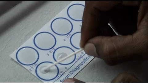 RPR test for syphilis