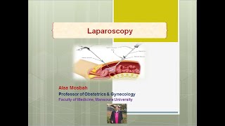 Laparoscopy