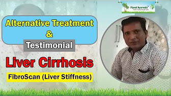 Watch Video Successful Liver Cirrhosis Treatment With Ayurveda - FibroScan,Real Feedback By Patient