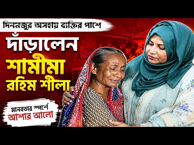 অসুস্থ হয়ে পা হারানো হাকুর চিকিৎসায় আর্থিক সহায়তা দিলেন শামীমা রহিম শিলা